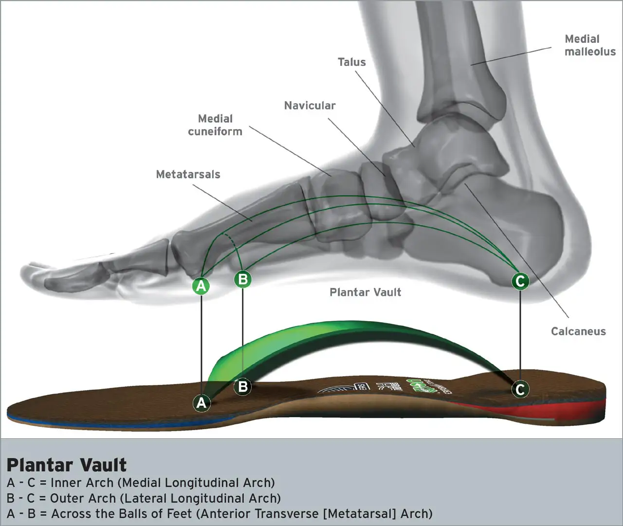 The three arches of the plantar vault — medial longitudinal, lateral longitudinal, and anterior transverse (metatarsal) arches — shown in anatomical side view with a FootLevelers orthotic